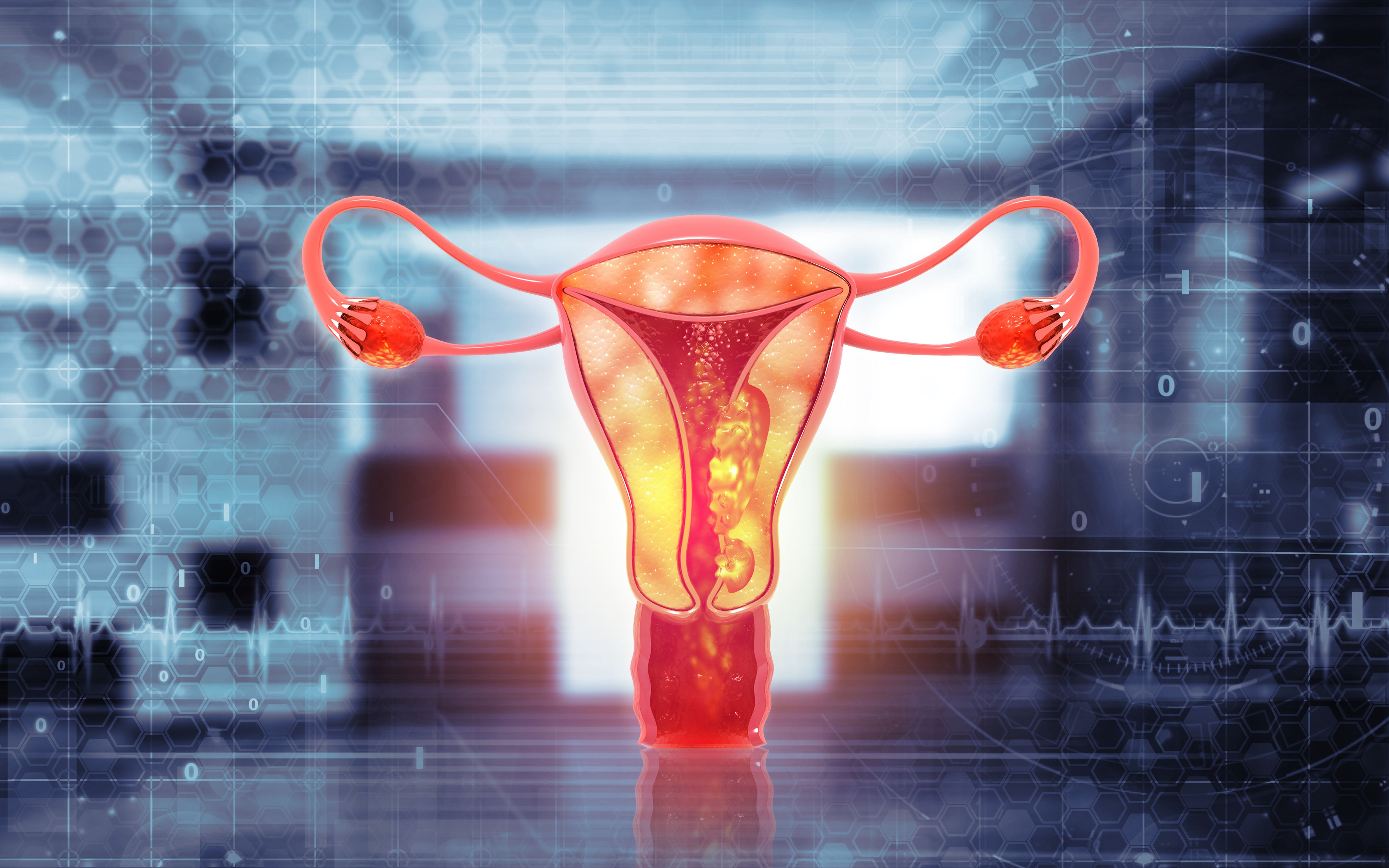 Cuanto tiempo tarda en desarrollarse un cáncer de endometrio