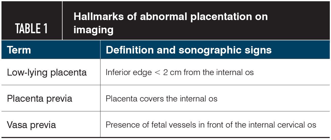 Placenta Previa Practical Approach To Sonographic Evaluation And Management