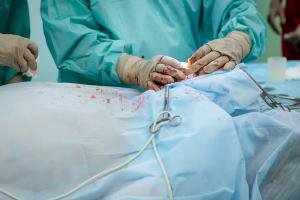 Pilot study of novel technique for POP repair