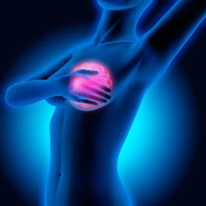 Breast cancer risk assessment and screening