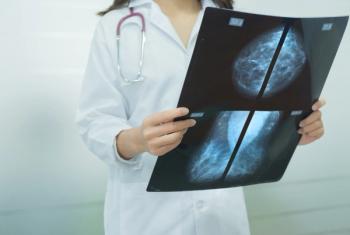 Selective focus Mammogram film image in female doctor hands.