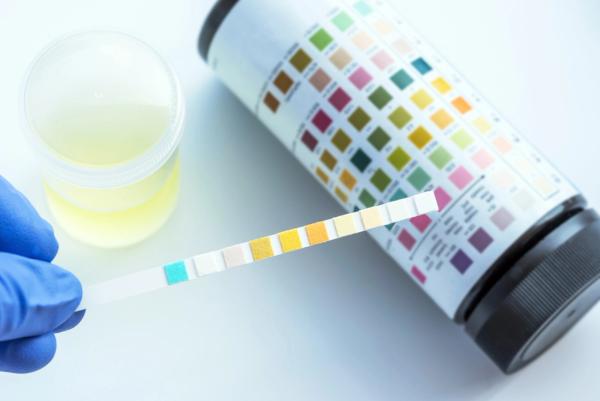 Urinalysis for the ob-gyn: Advanced interpretation, when to refer, and underappreciated parameters