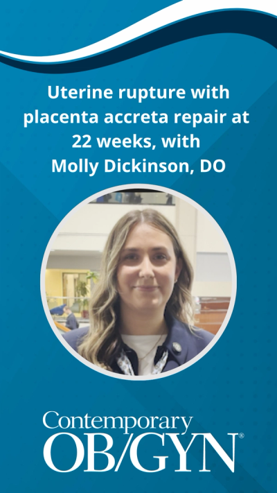  Uterine rupture with placenta accreta repair at 22 weeks