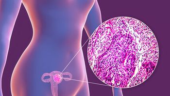 sentinel lymph node mapping