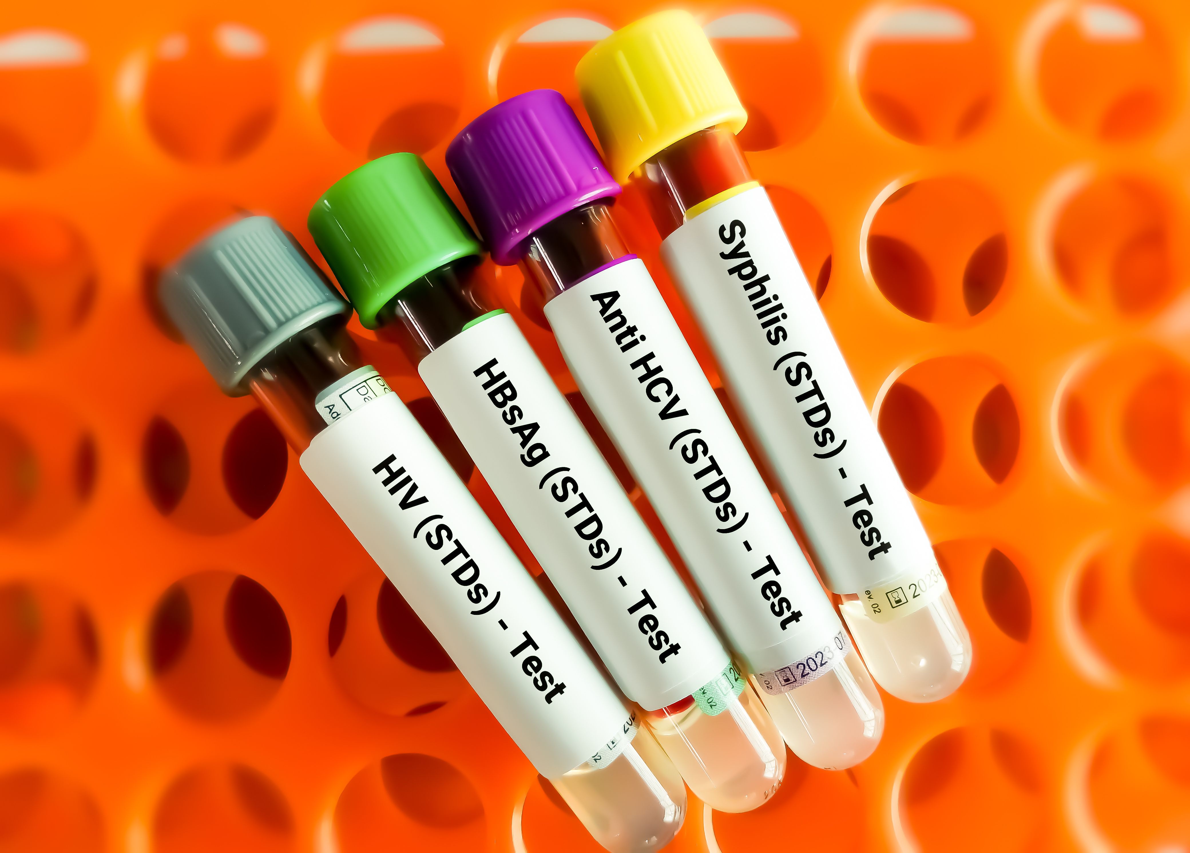 STIs during pregnancy linked to higher risk of birth complications STIs during pregnancy linked to higher risk of birth complications