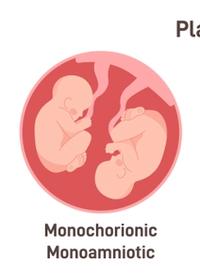 Society for Maternal-Fetal Medicine updates checklists for monochorionic twin pregnancies  | Image Credit: ©  inspiring.team - ©  inspiring.team - stock.adobe.com.