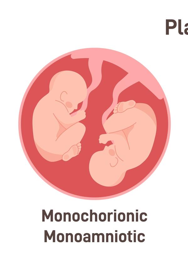 Society for Maternal-Fetal Medicine updates checklists for monochorionic twin pregnancies  | Image Credit: ©  inspiring.team - ©  inspiring.team - stock.adobe.com.