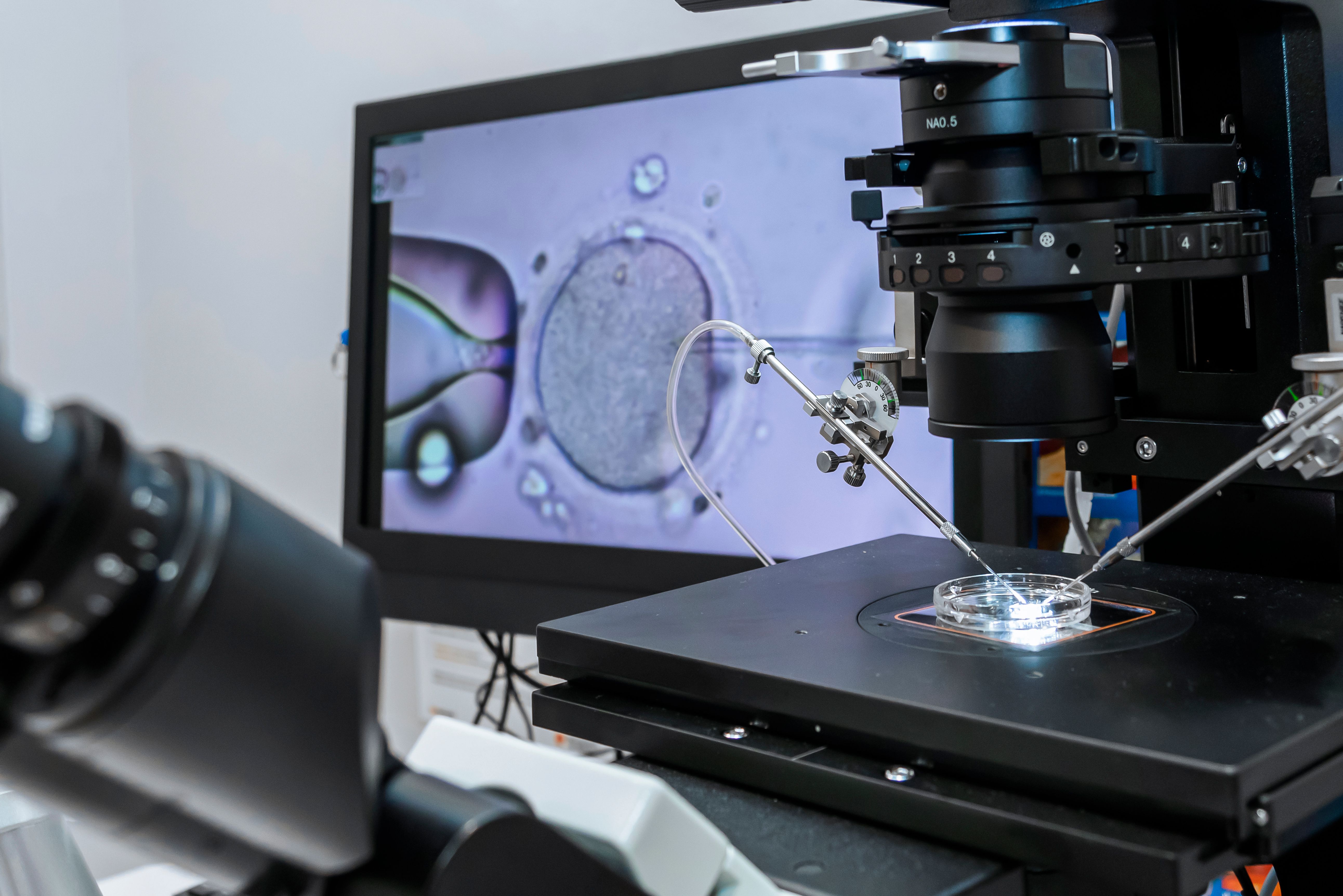 Fresh embryo transfer boosts IVF success for low-prognosis women | Image Credit: © Medical Works - © Medical Works - stock.adobe.com.