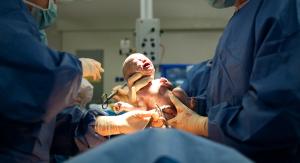 Evidence-based cesarean delivery guidelines