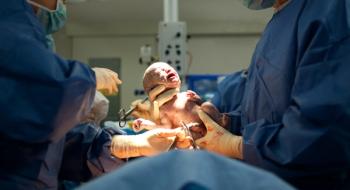 Cesarean Delivery