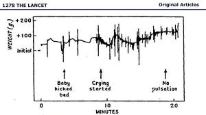 Neonatal Resuscitation: Life that Failed