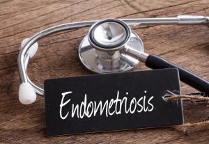 Endometriosis