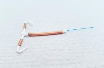 copper iud