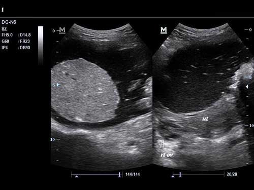 Image IQ: A Pelvic Mass