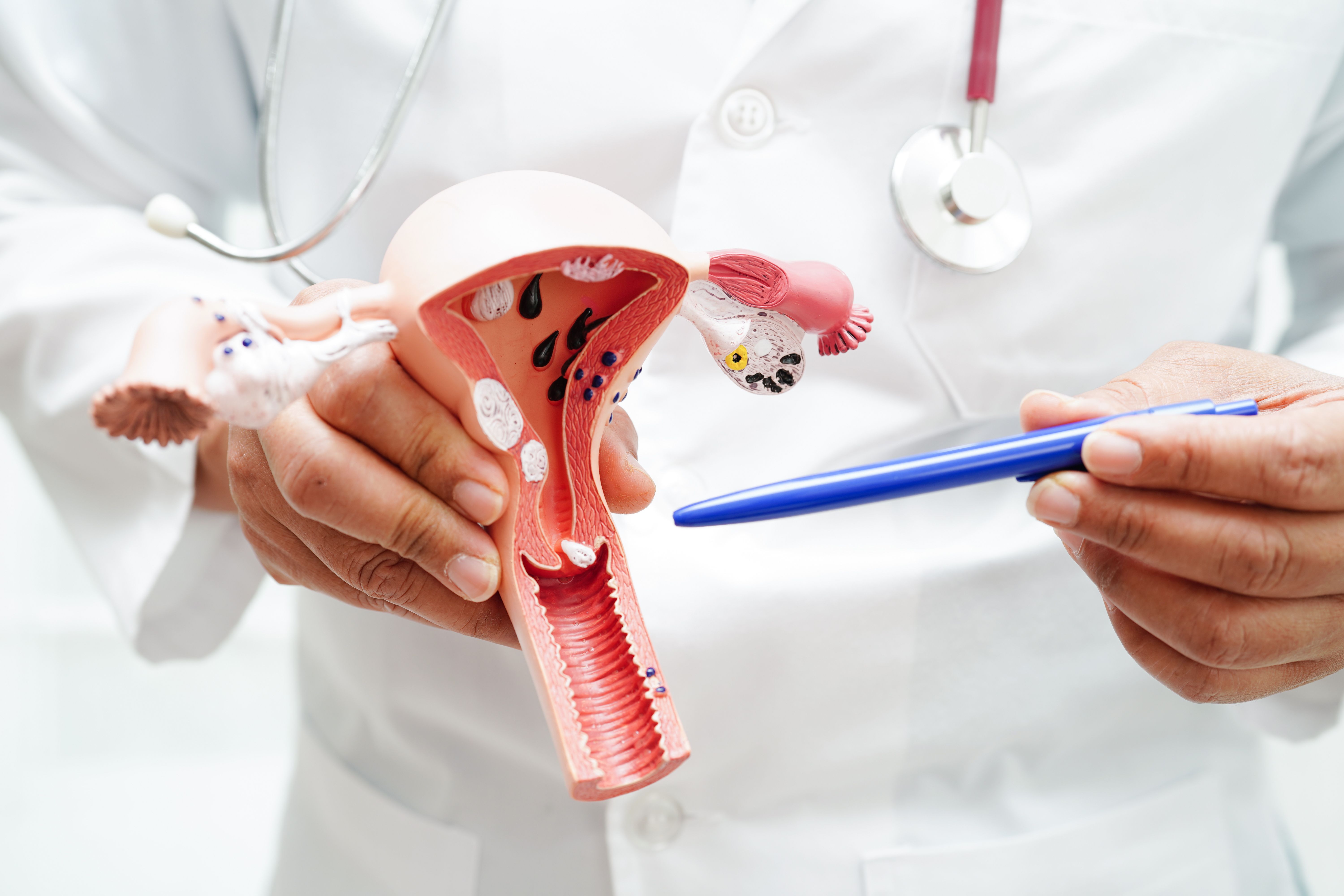 Outpatient cervical ripening with a Foley catheter | Image Credit: © manassanant - © manassanant - stock.adobe.com.