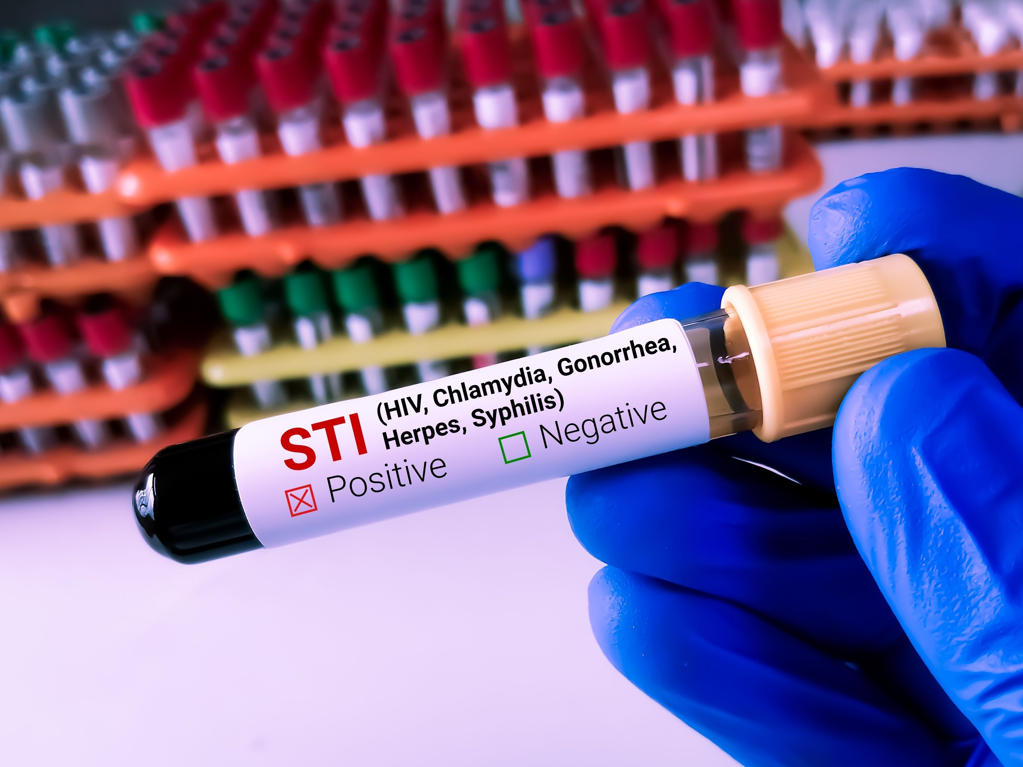 Understanding pediatric STIs: Trends, management, and more. | Image Credit: © Saiful52 - © Saiful52 - stock.adobe.com.