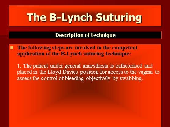 The B-Lynch Suturing