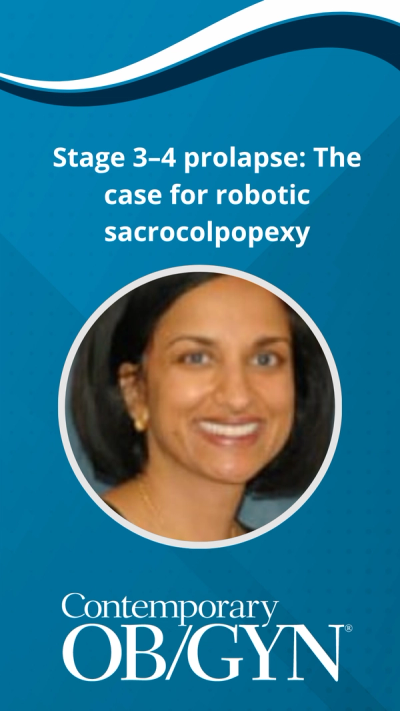 Stage 3–4 prolapse: The case for robotic sacrocolpopexy