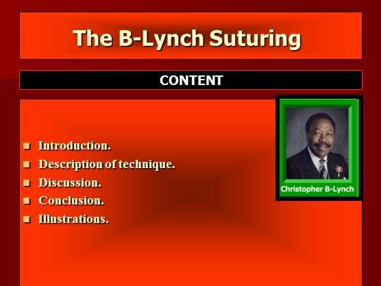 The B-Lynch Suturing