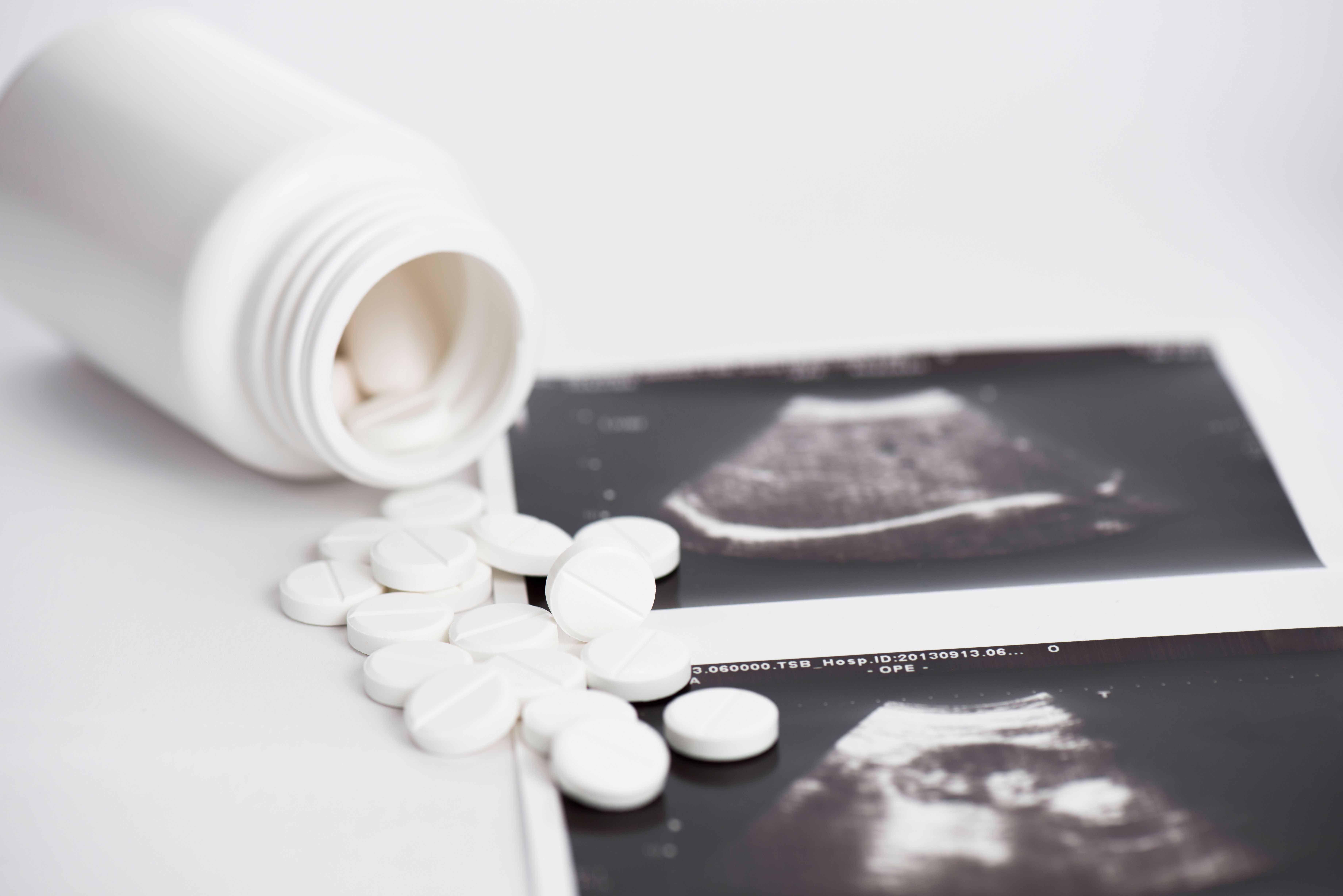 Letrozole, misoprostol combination ineffective for terminating pregnancy