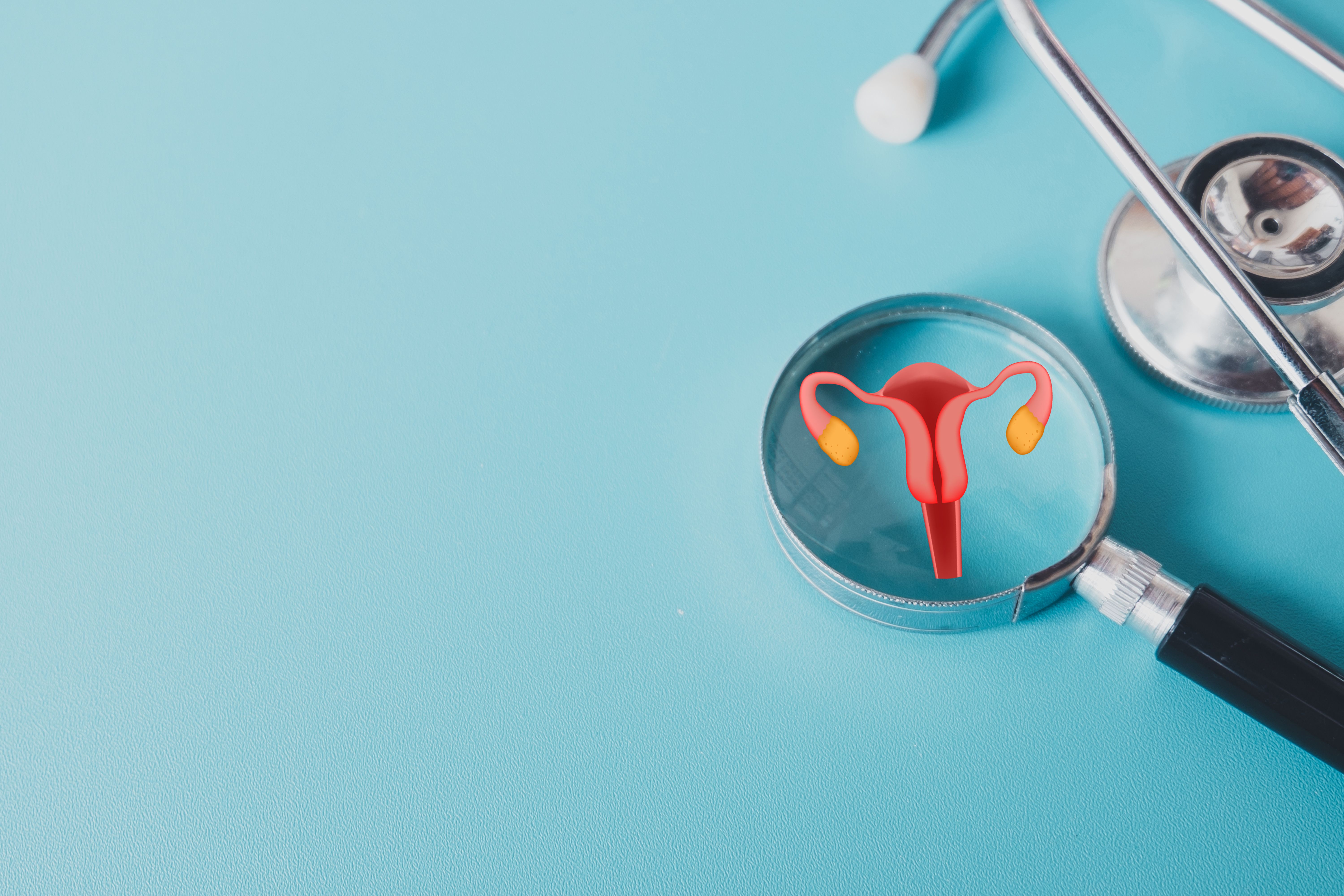 Study highlights how PCOS alters uterine lining Study highlights how PCOS alters uterine lining