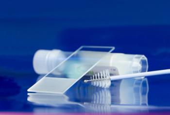 Study: African American women with SLE need better education about their HPV, cervical cancer risk | Image Credit: © Beate Panosch - © Beate Panosch - stock.adobe.com.