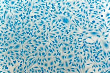 Study finds cervical cancer risk high in women aged over 65 years | Image Credit: © heitipaves - © heitipaves - stock.adobe.com.