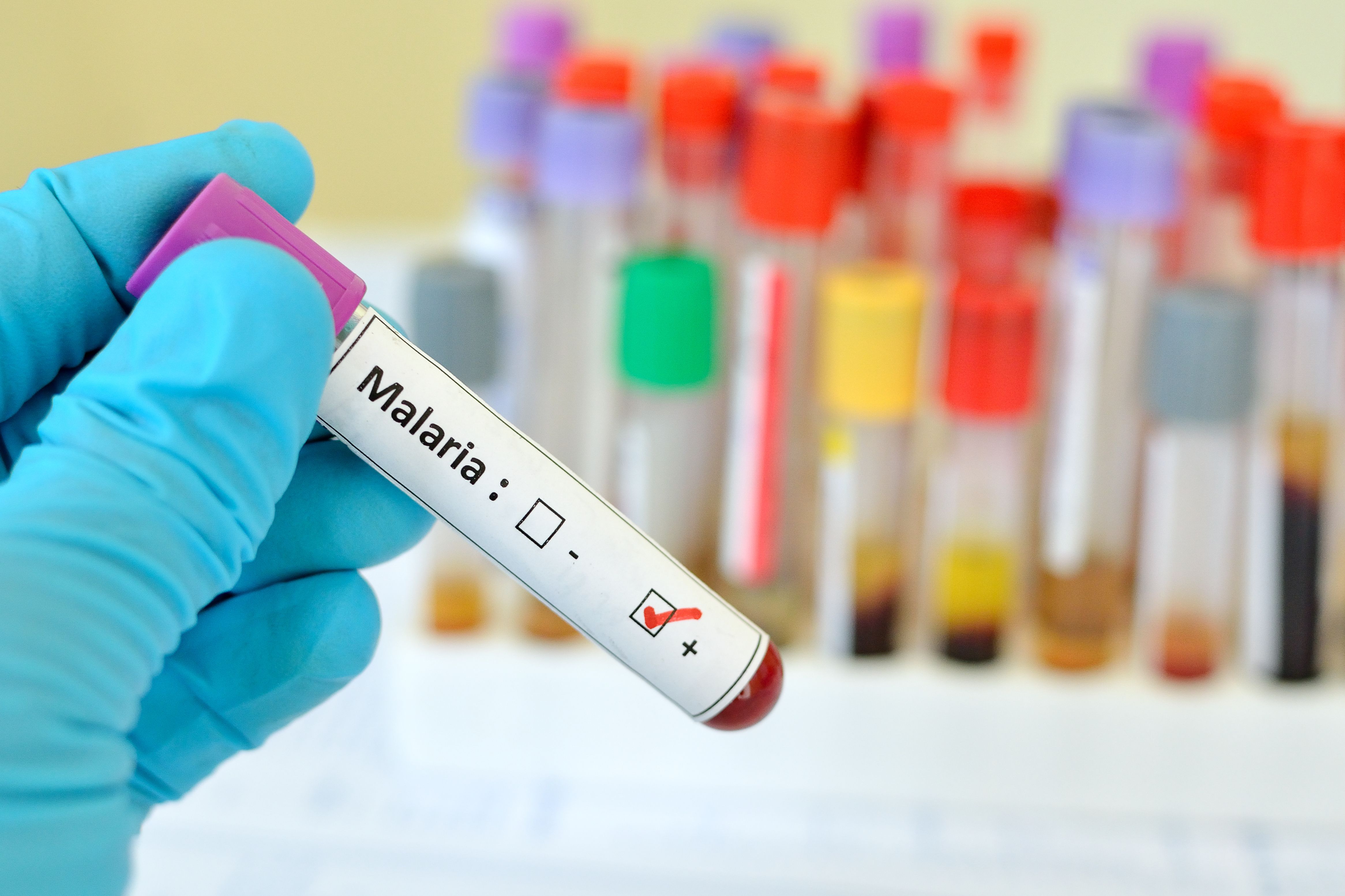 Maternal malaria and preterm birth linked to higher infant malaria risk Maternal malaria and preterm birth linked to higher infant malaria risk
