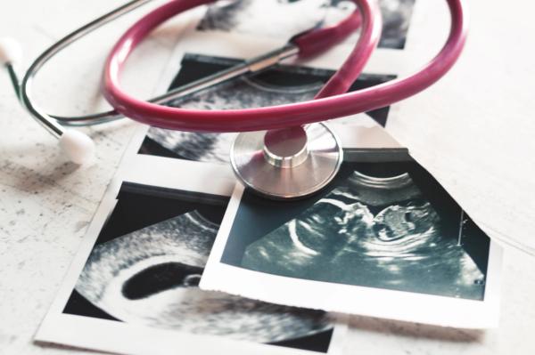 20-year data show shifting causes of pregnancy-related death | image credit: stock.adobe.com