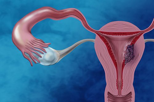 What endometrial thickness is abnormal?