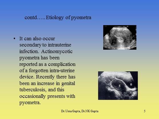 Pyometra: Diagnosis and Management