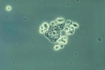 Trichomonas vaginalis