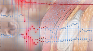Managing obstetric emergencies: Anaphylactoid syndrome of pregnancy (aka AFE)