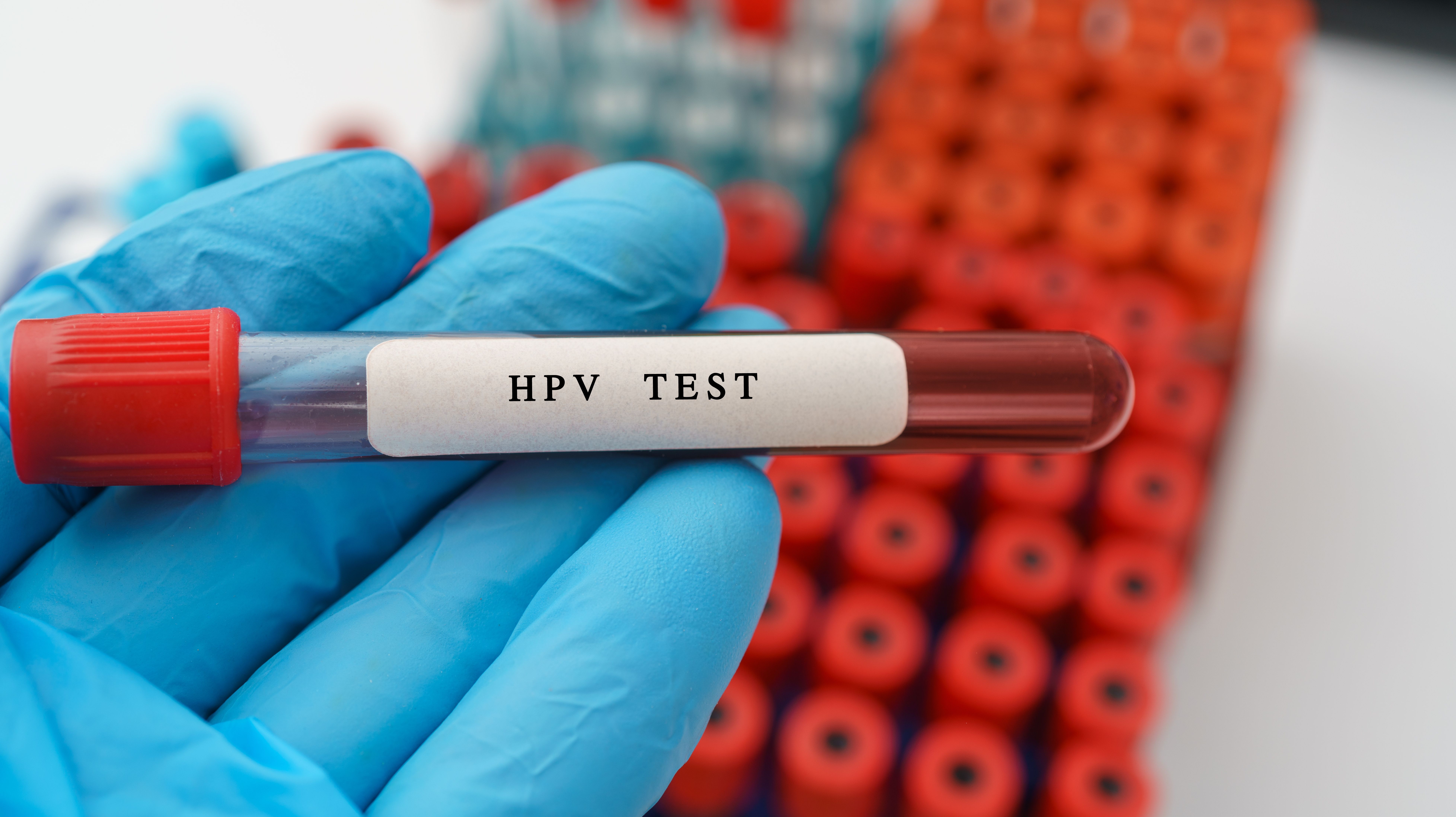 Mail-in HPV self-tests found to double cervical cancer screening rates Mail-in HPV self-tests found to double cervical cancer screening rates