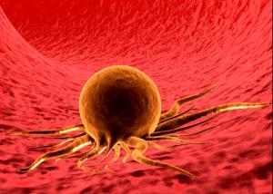  FDA grants olaparib priority review in BRCA-mutated HER2-negative high-risk early breast cancer