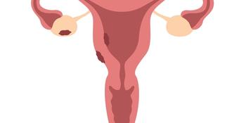 Molecule shows promise for MASH, endometriosis, and other chronic diseases |  Image Credit: © krissikunterbunt - © krissikunterbunt - stock.adobe.com.