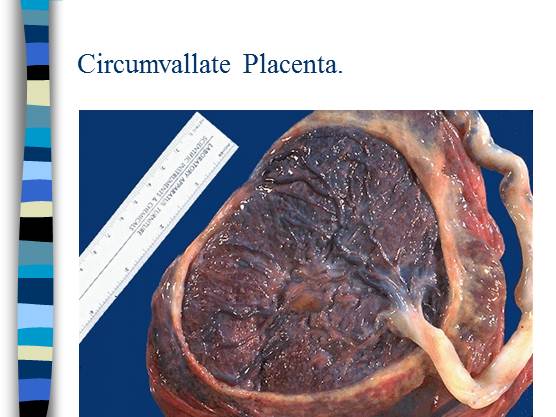 spuria placenta