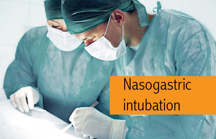 Nasogastric intubation
