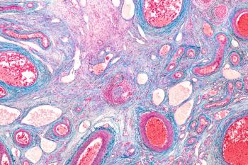 Safe ovarian tissue transplantation after stem cell treatment for acute leukemia | Image Credit: © sinhyu - © sinhyu - stock.adobe.com.