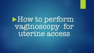How to perform vaginoscopy for uterine access