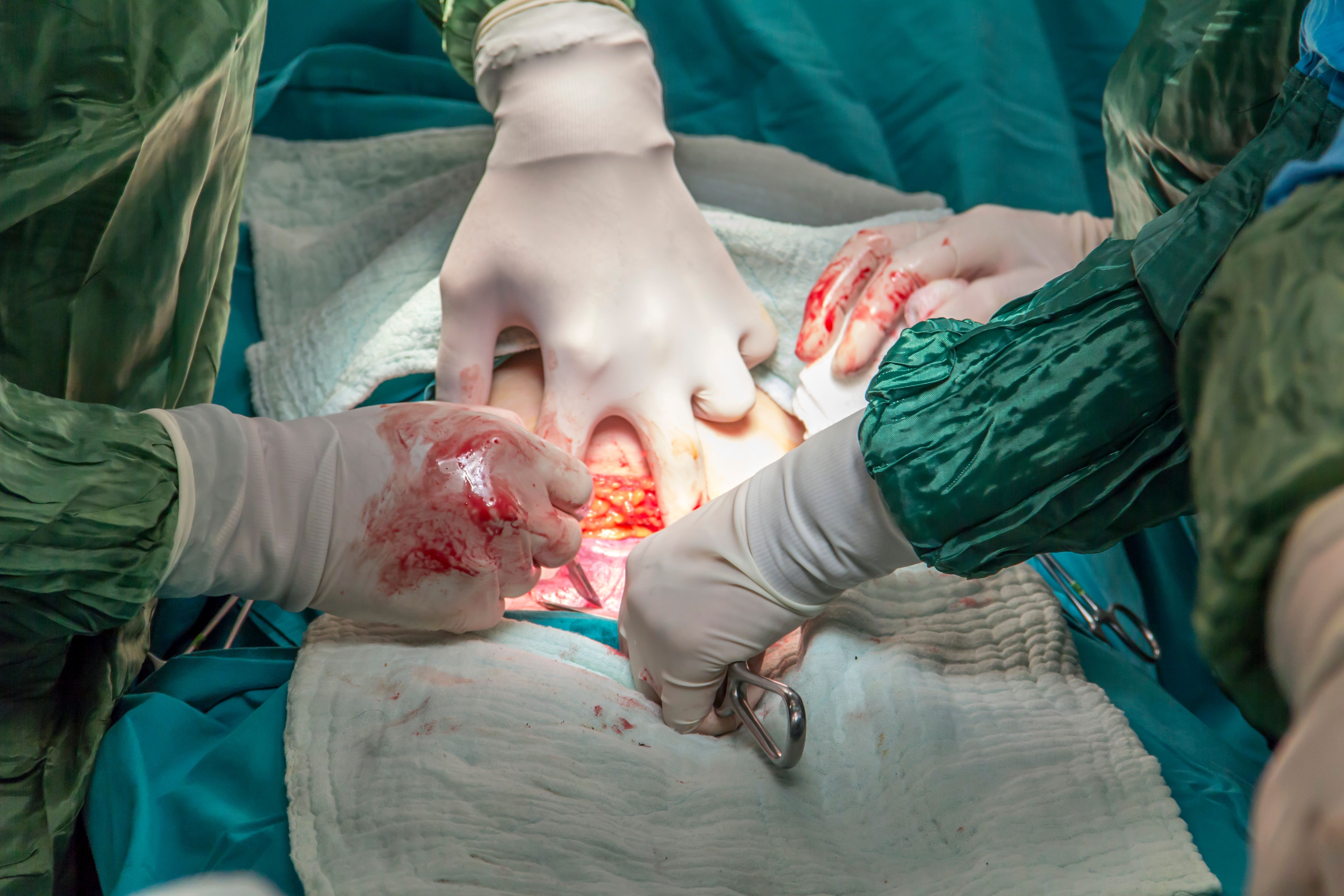 Adobe Stock/ cnky photography