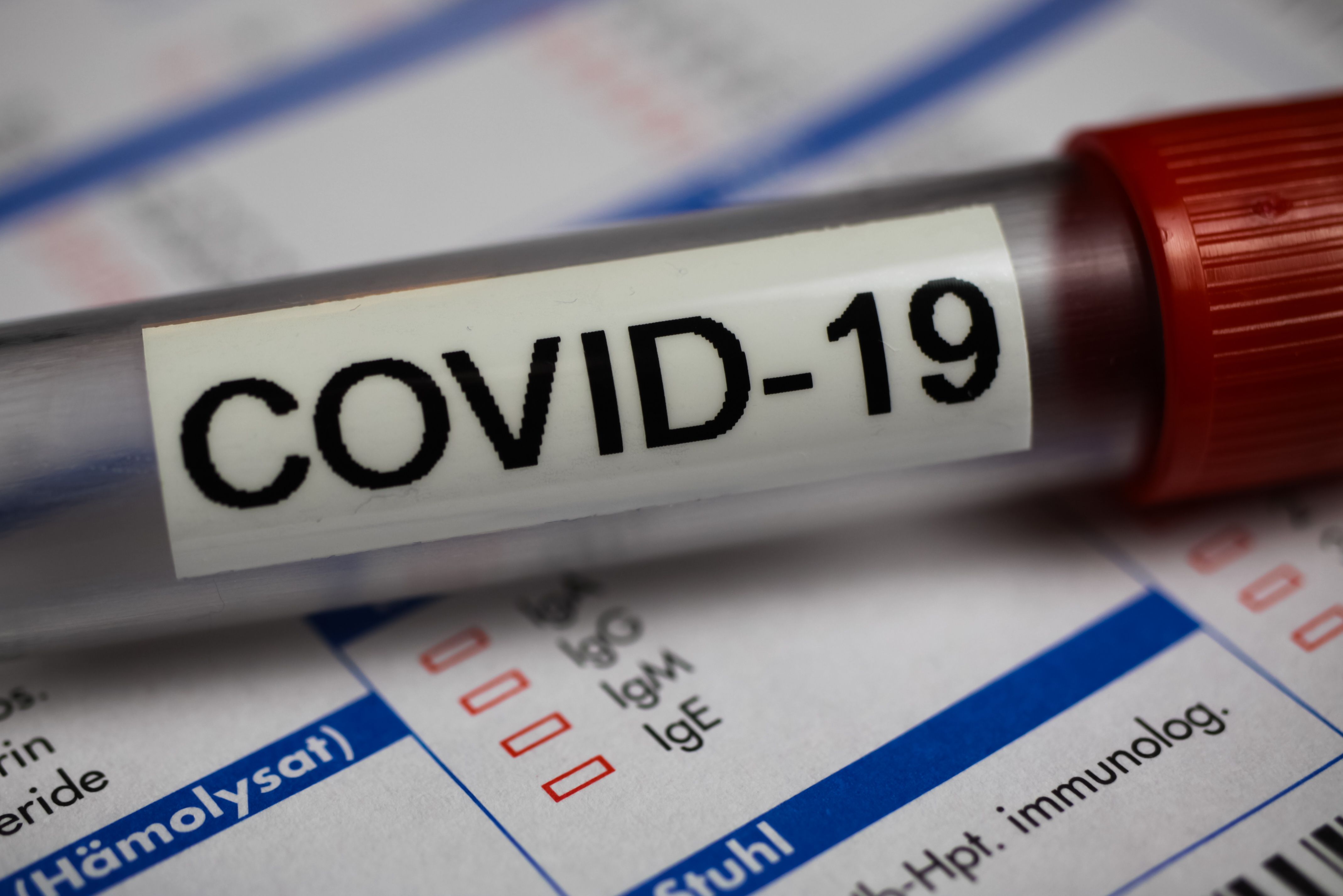 COVID-19 vaccine dosing impact on maternal and infant antibodies | Image Credit: © Ralf - © Ralf - stock.adobe.com.