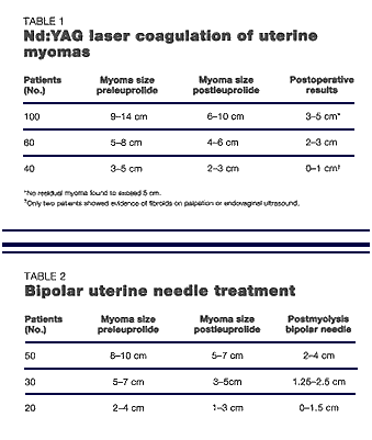 Removing Uterine Fibroids Laparoscopically Contemporary Ob Gyn