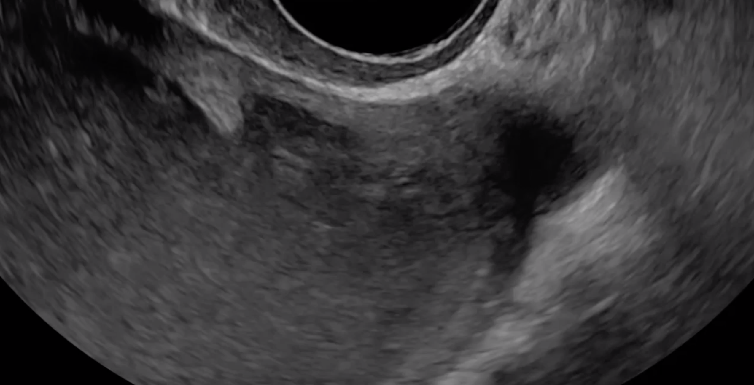 Normal vagina | Contemporary OB/GYN