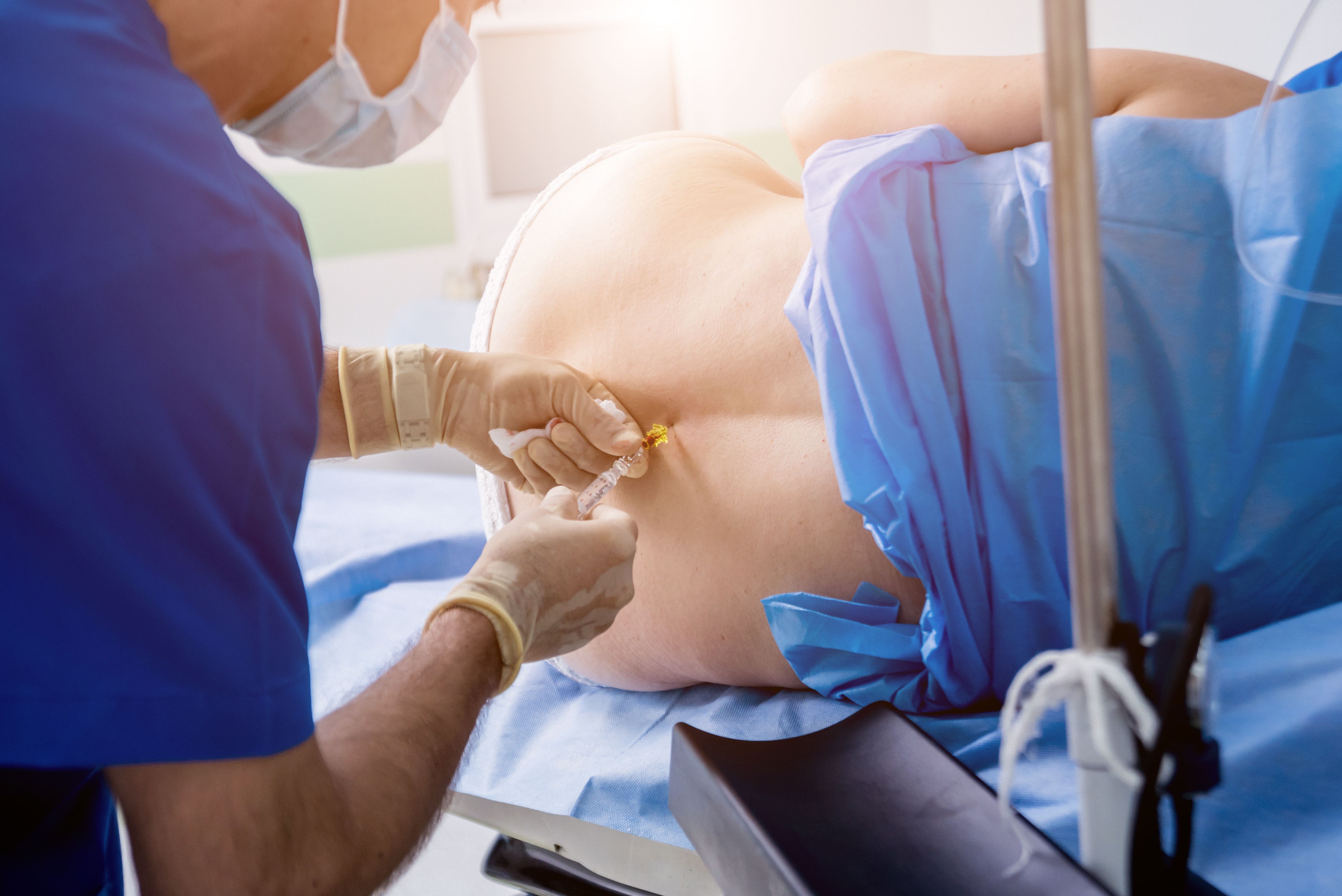 Epidural analgesia during labor linked to reduced severe maternal morbidity risk | Image Credit: © romaset - © romaset - stock.adobe.com.