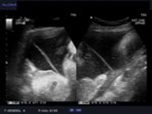 DailyDx: An Obstetric Quiz