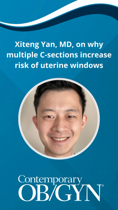 Xiteng Yan, MD, on why multiple C-sections increase risk of uterine windows
