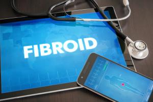 Fibroids