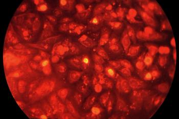 This photomicrograph depicts HeLa cells infected with Type-A Chlamydia trachomatis, Magnified 400X.
