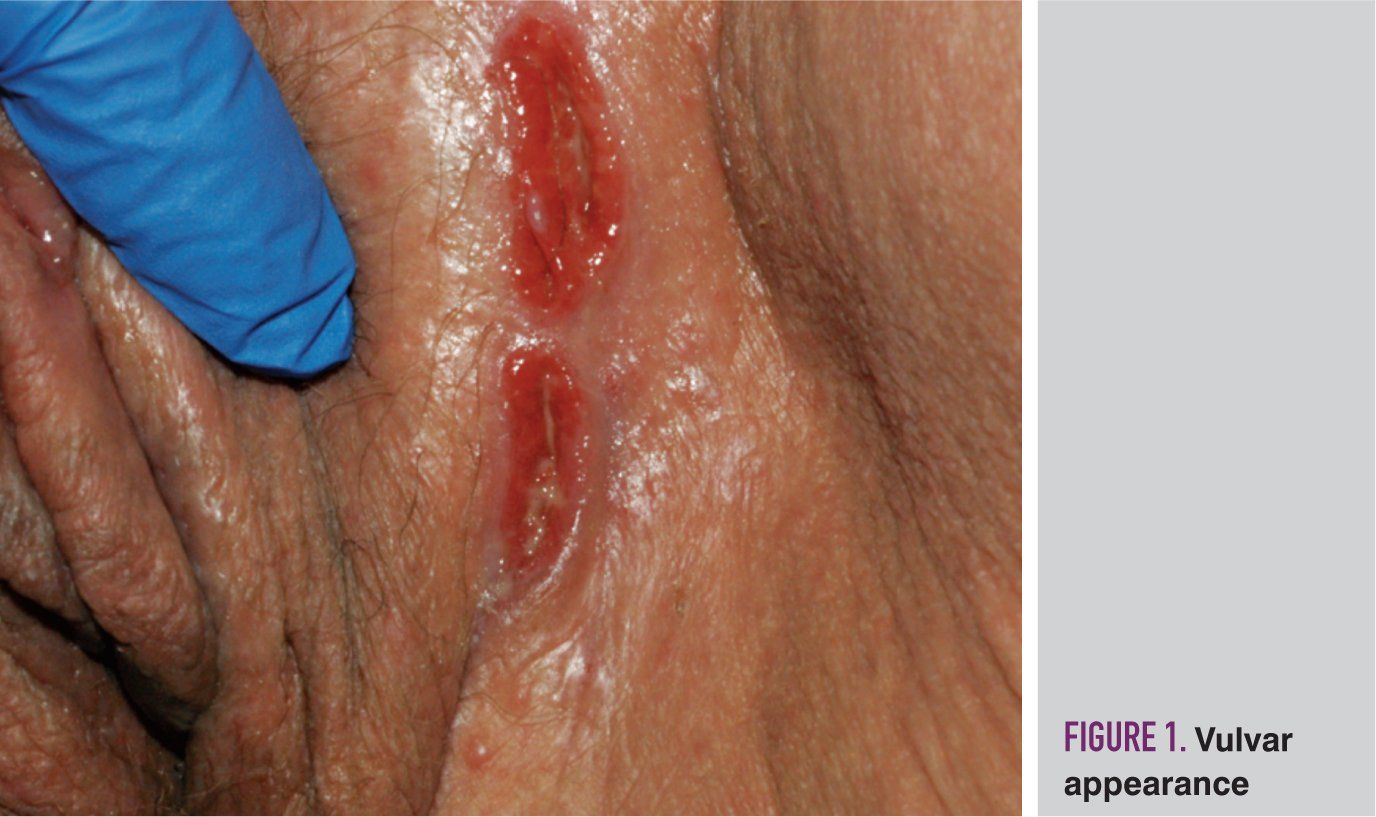 Norvegiya porno rasmlar